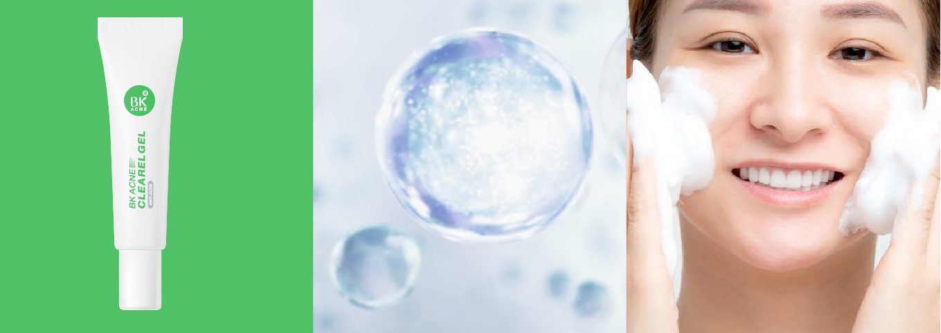 BK Acne